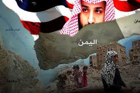بشرى قووية جدااا..."الملك سلمان" يوجه بدك المتمردين في صنعاء !! تفاصيل ارعبت المشاط وعبدالملك الحوثي 